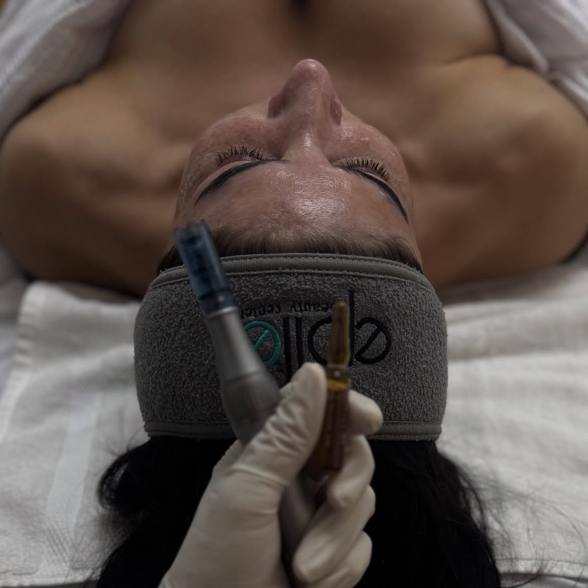 Aplicación de Dermaplaning por enfermera en Epilé Beauty Center